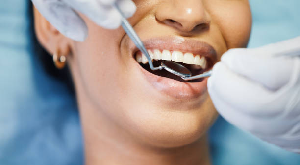 Best Emergency Dentist for Knocked-Out Tooth in Grosse Pointe, MI